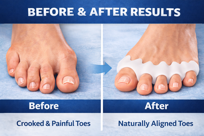 ToeAlign Pro - Instant Pain Relief (Pack of 2)