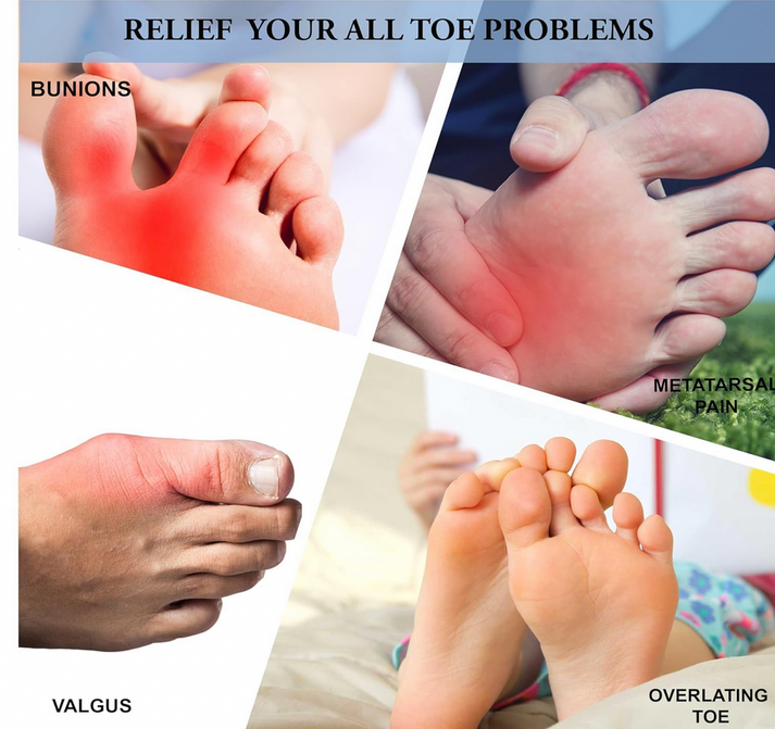 ToeAlign Pro - Instant Pain Relief (Pack of 2)